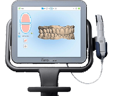 Invisalign intraoral scanning equipment, 3D teeth model on screen